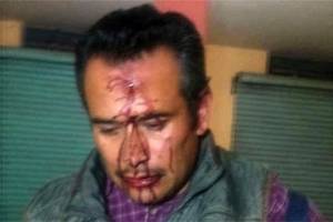Presuntos priistas atacan a candidato suplente del PAN en Zacapoaxtla