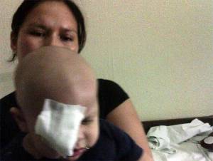 IMSS: médico fue negligente al extirpar ojo sano a bebé