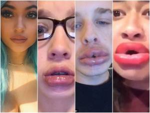 FOTOS: Fans dañan sus labios para imitar a Kylie Jenner