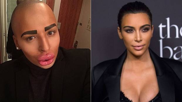 Hombre gastó 150 mil dólares para parecerse a Kim Kardashian