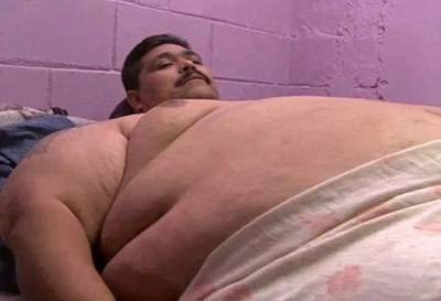 Operan en Guadalajara al hombre más obeso del mundo