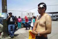 Grupos de ambulantes se enfrentan en Puebla por espacios; hay 5 heridos