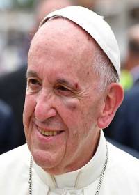 ¿Quién le dejó el ojo morado al Papa Francisco?