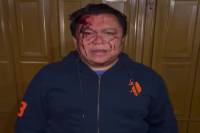 VIDEO: Líder sindical del Ayuntamiento de Puebla acusa agresiones y amenazas de muerte