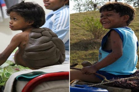 Descubren a niño tortuga en Colombia