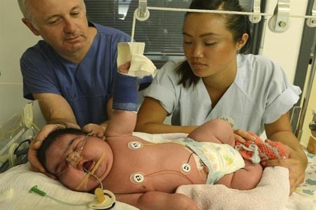 Conoce a Jasleen, la bebé gigante de Alemania