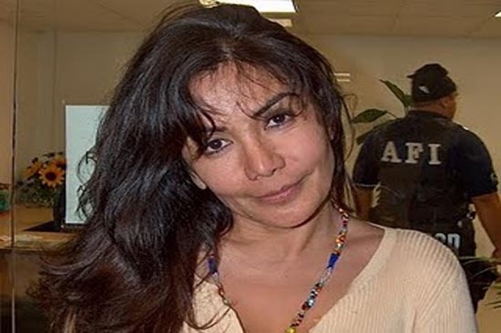 Reina del Pacífico, inocente de tratamiento de bótox