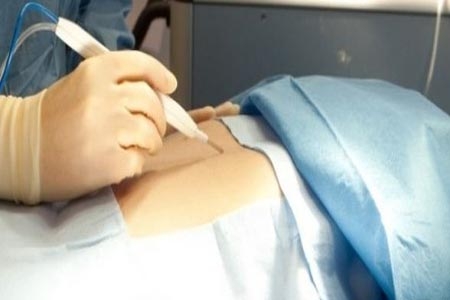 Presentan bisturí que detecta cáncer