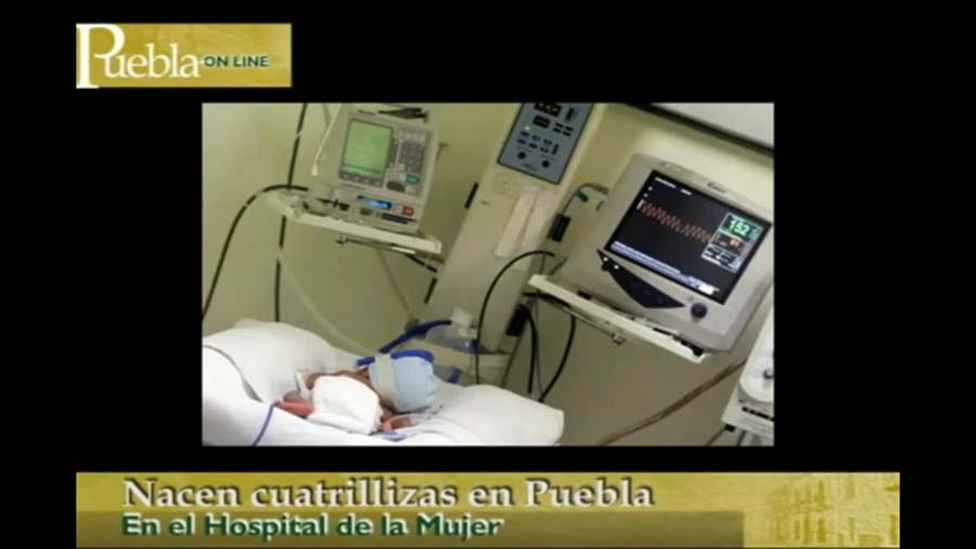 Cuatrillizas: la mamá podría salir este domingo del Hospital de la Mujer