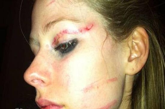 Avril Lavigne fue golpeada en un antro