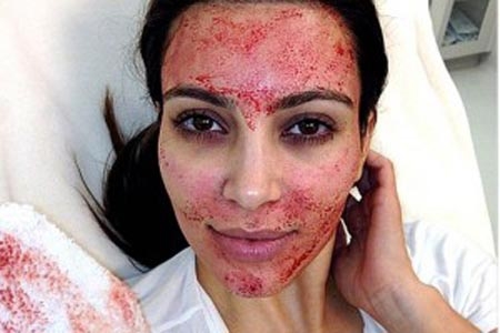 Kim Kardashian sufre para mantenerse bella