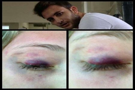 Hija de director del Cisen acusa a nieto de Murillo Karam de golpeador