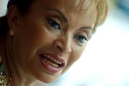 Elba Esther Gordillo, adicta al bisturí y a clínicas de rejuvenecimiento