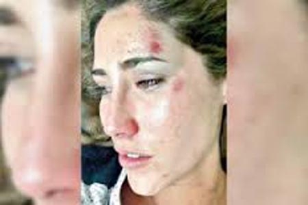 Kahwagi niega haber golpeado a ex novia; fotos lo desmienten