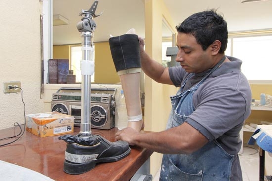 DIF Estatal ha elaborado más de 500 prótesis para personas discapacitadas
