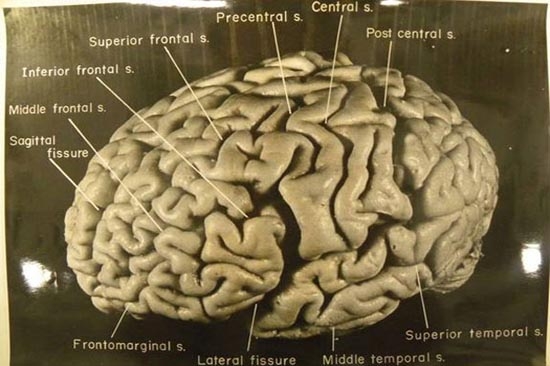 Albert Einstein tenía un cerebro especial