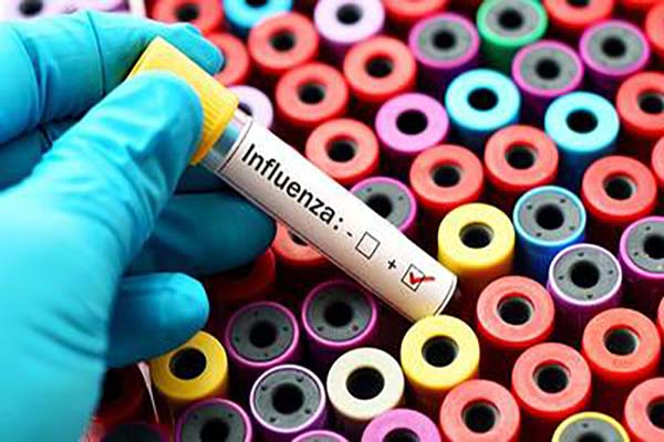 Puebla reporta nueve defunciones por influenza y 100 casos positivos