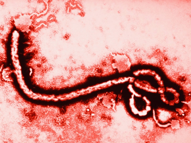 Mexicano crea método rápido para detectar ébola