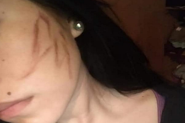 Joven fue golpeada y escapó a intento de violación en Puebla