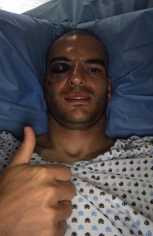 Lobos BUAP: Lucero Álvarez estuvo cerca de perder el ojo