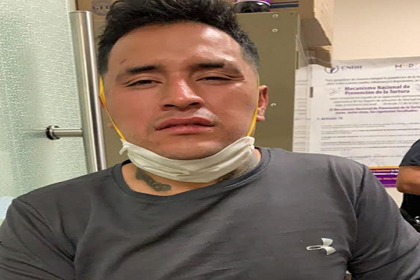 Sujeto detenido por lesiones se escapa del Complejo de Seguridad C5