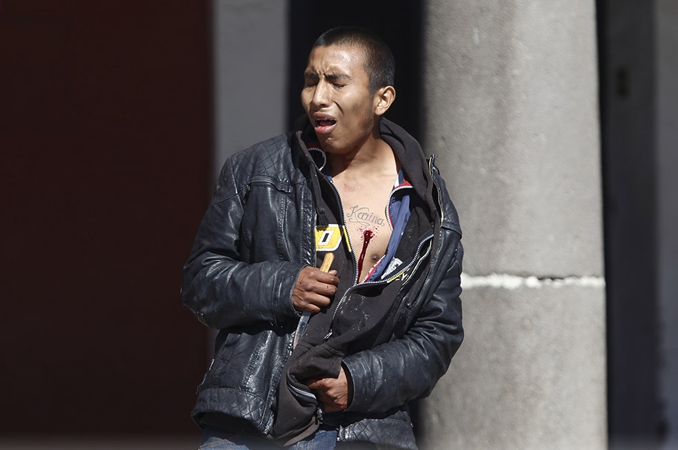 FOTOS: Hombre se acuchilla varias veces en pleno centro de San Pedro Cholula
