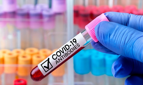 Empresa mexicana moderniza pruebas de anticuerpos para detectar COVID