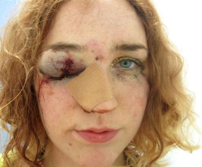 Mujer víctima de machismo publicó selfie con rostro golpeado