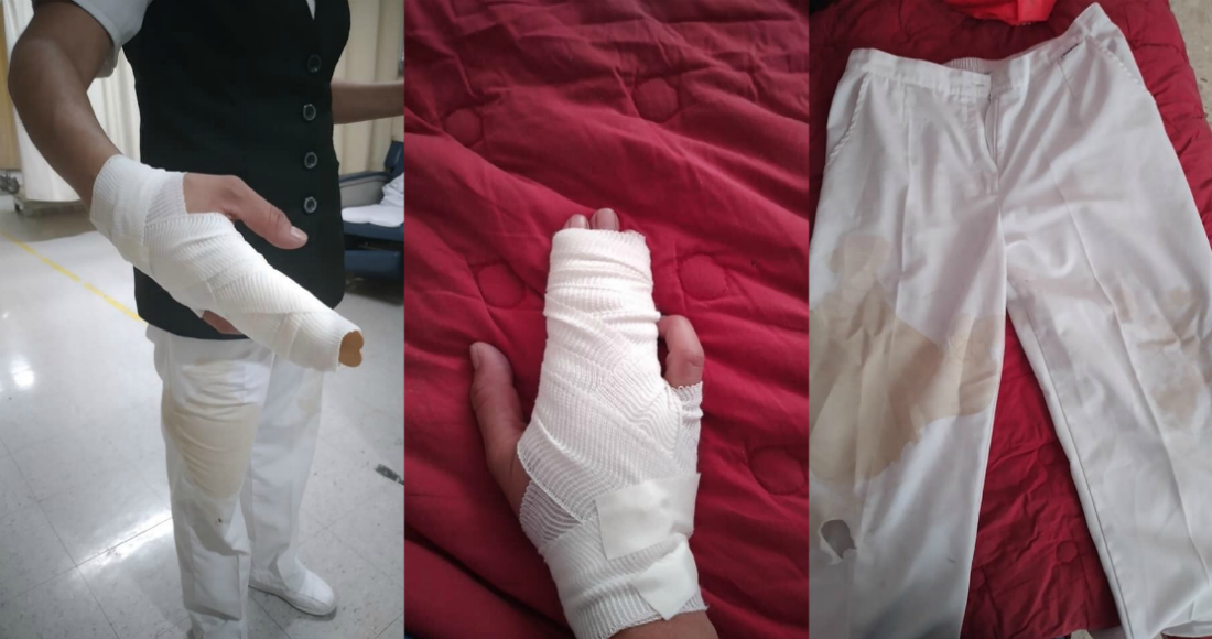 Golpean y fracturan a enfermera en SLP por “temor” al coronavirus