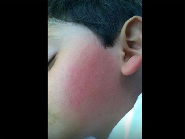 Maestra golpea a niño de 4 años y le revienta el oído