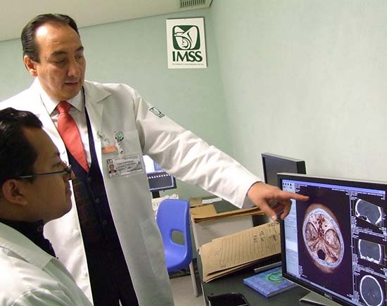 ¿Cómo detectar si tienes un tumor cerebral?