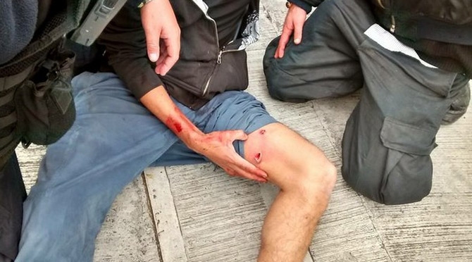 Agente de la PGJDF dispara contra estudiante en CU de la UNAM