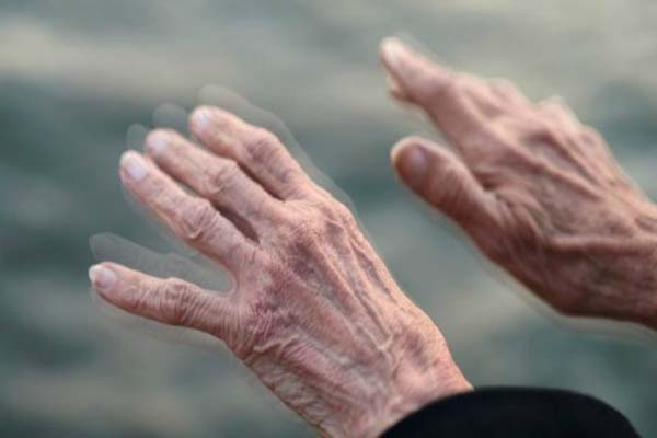 Día Mundial del Parkinson: incrementan 112% muertes en Puebla este año