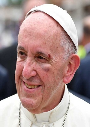 ¿Quién le dejó el ojo morado al Papa Francisco?