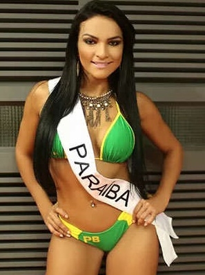 FOTOS: Ex participante de Miss Bumbum quiso suicidarse y quedó parapléjica