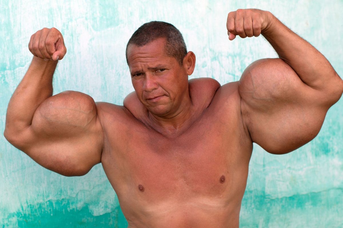 Hulk sí existe y es brasileño