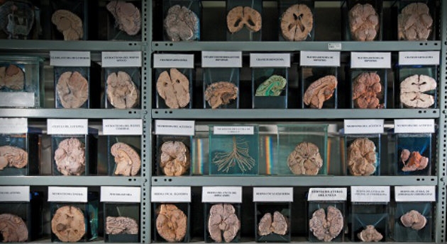 La colección de cerebros más grande del mundo