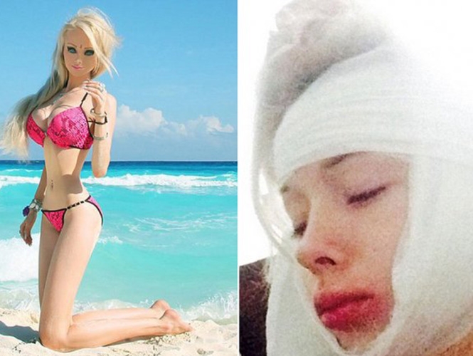 FOTOS: Barbie humana fue desfigurada a golpes