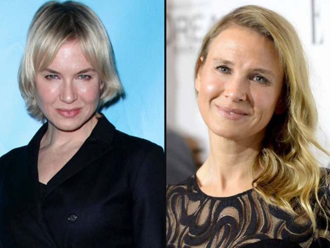 Renée Zellweger revela lo que le pasó a su rostro