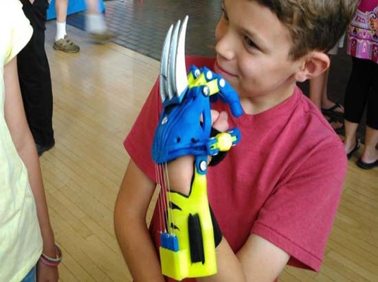 Prótesis impresas en 3D convierten a niños en Wolverine