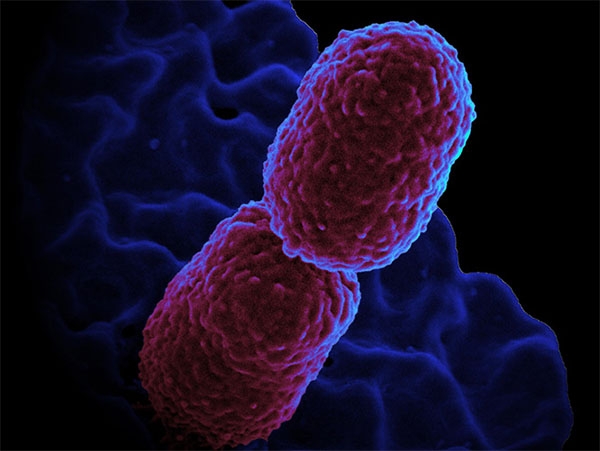 Dos personas mueren en Florida por bacteria come carne