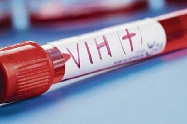 A la semana se reportan tres casos de SIDA en Puebla
