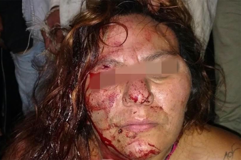 Casi linchan a mujer por intentar robar en vivienda de La Resurrección
