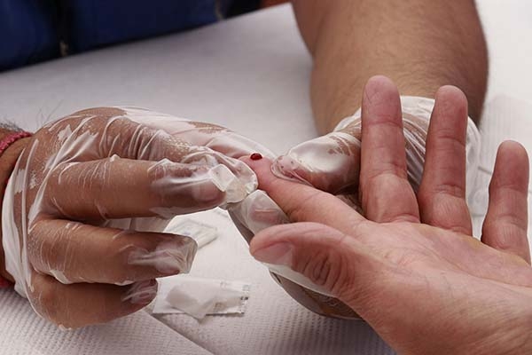 Puebla dentro de los 10 estados con más casos diagnosticados de SIDA en lo que va del año