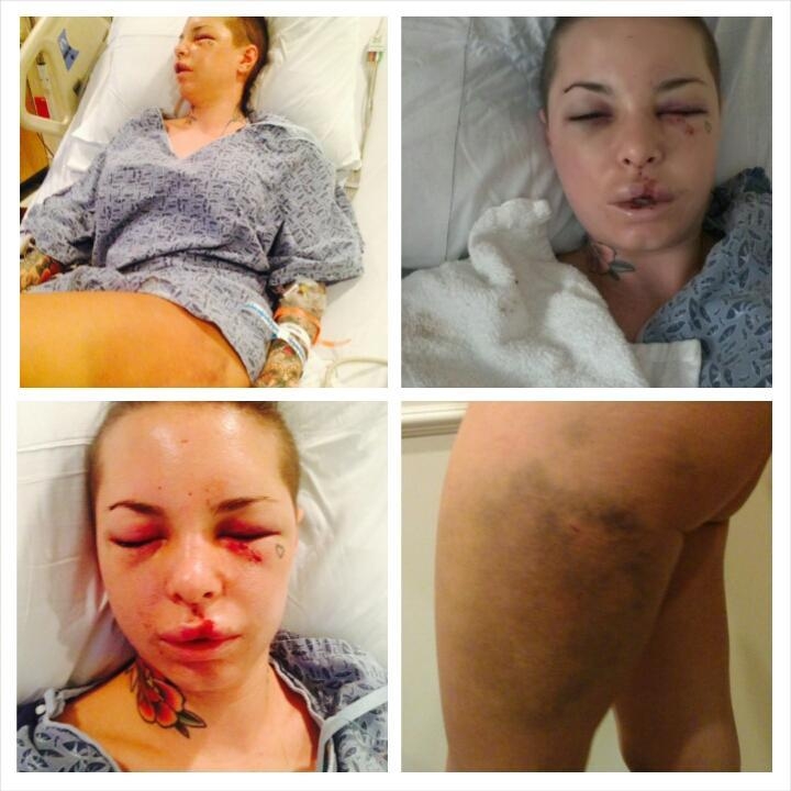 Actriz porno recibió golpiza de su ex novio luchador en Las Vegas