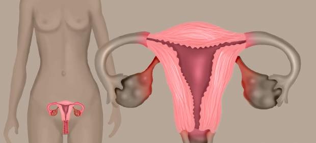Hombre descubre que es mujer tras dolor de estómago