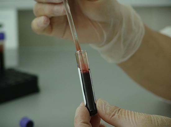 Crean vacuna experimental que crea anticuerpos para VIH