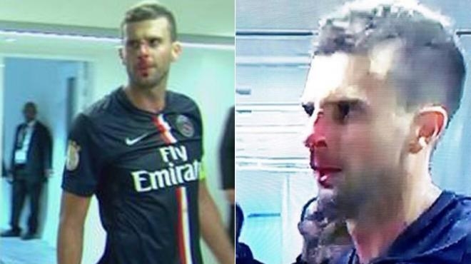 VIDEO y FOTO: Thiago Motta recibe cabezazo y le rompen la nariz