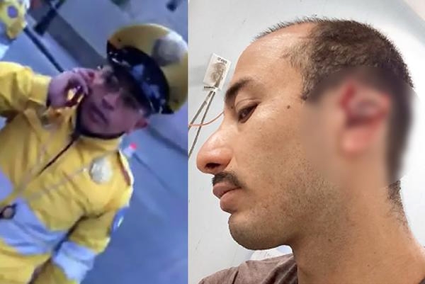 VIDEO: Tránsito del DF le corta la oreja a conductor