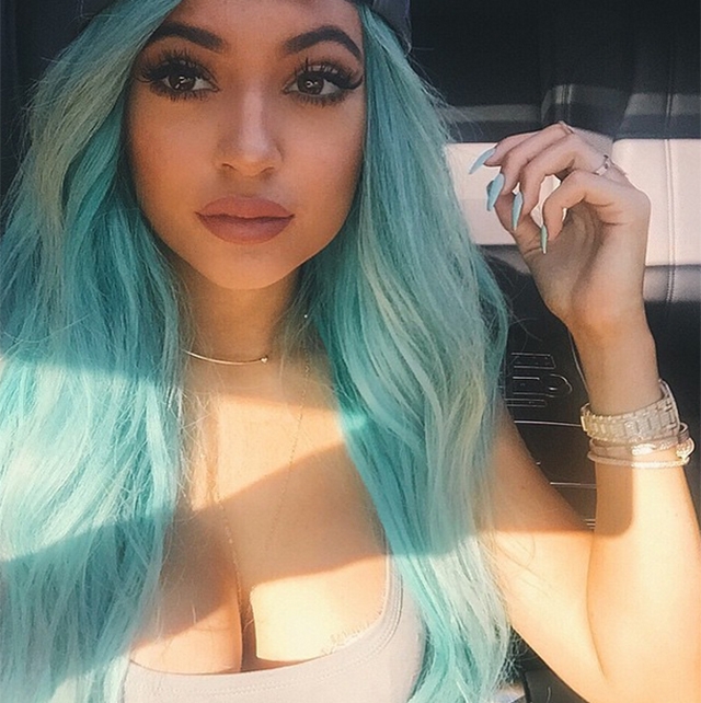 FOTOS: Khloé Kardashian revela que se operó los labios